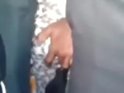বিশারদ প্রতিস্থাপন,  ...